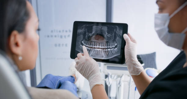 Licensed Invisalign Clear Aligners service in San Ramon, CA - Smile Center Dentistry